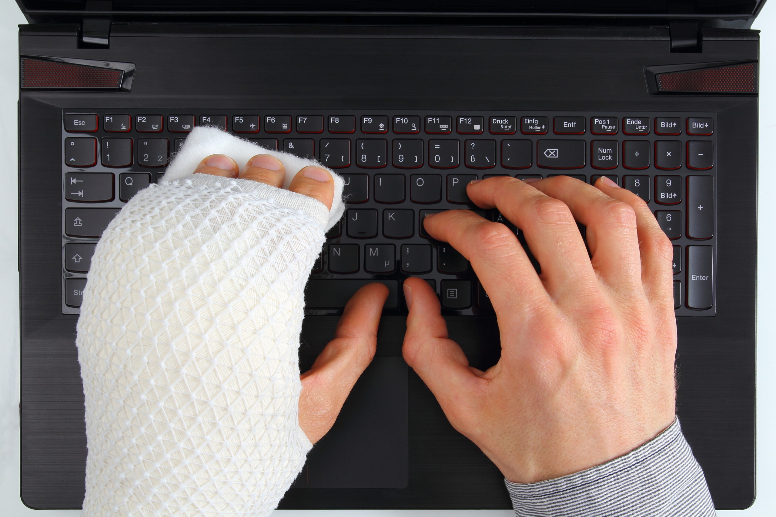 An injured man works on a laptop.